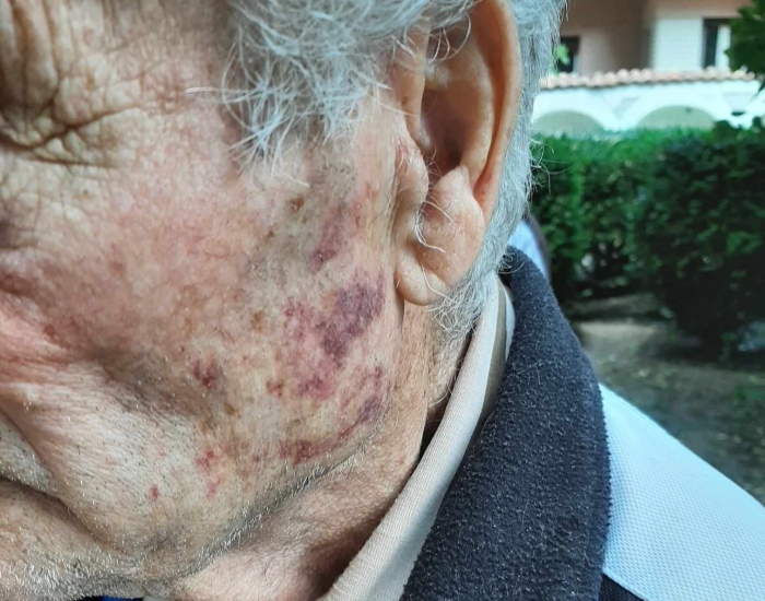 Син преби баща си в кюстендилското село Лозно 