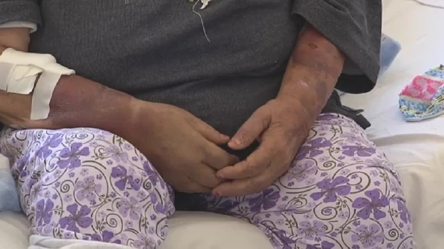 Мъж от Брезник преби възрастната си майка