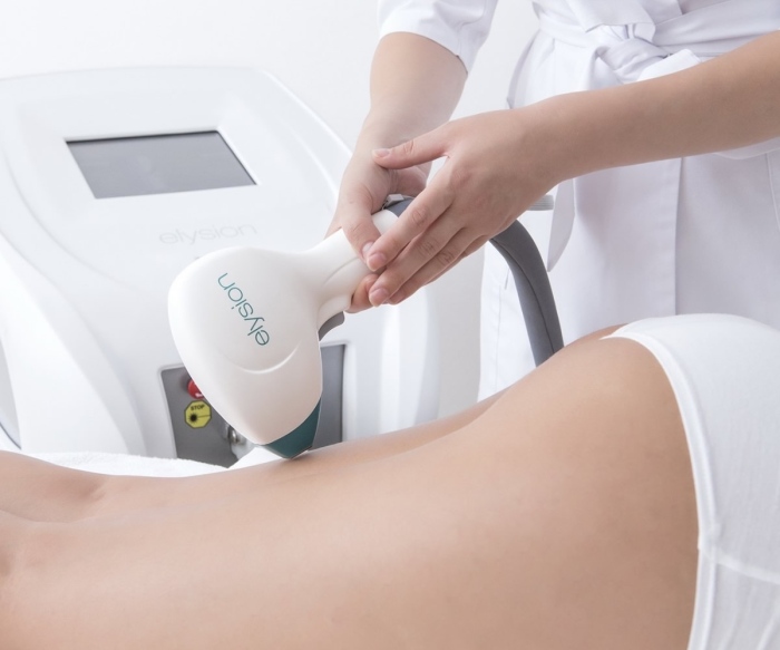 Скандалът с тайните камерите в салони се разраства - близо 100 подадени сигнала