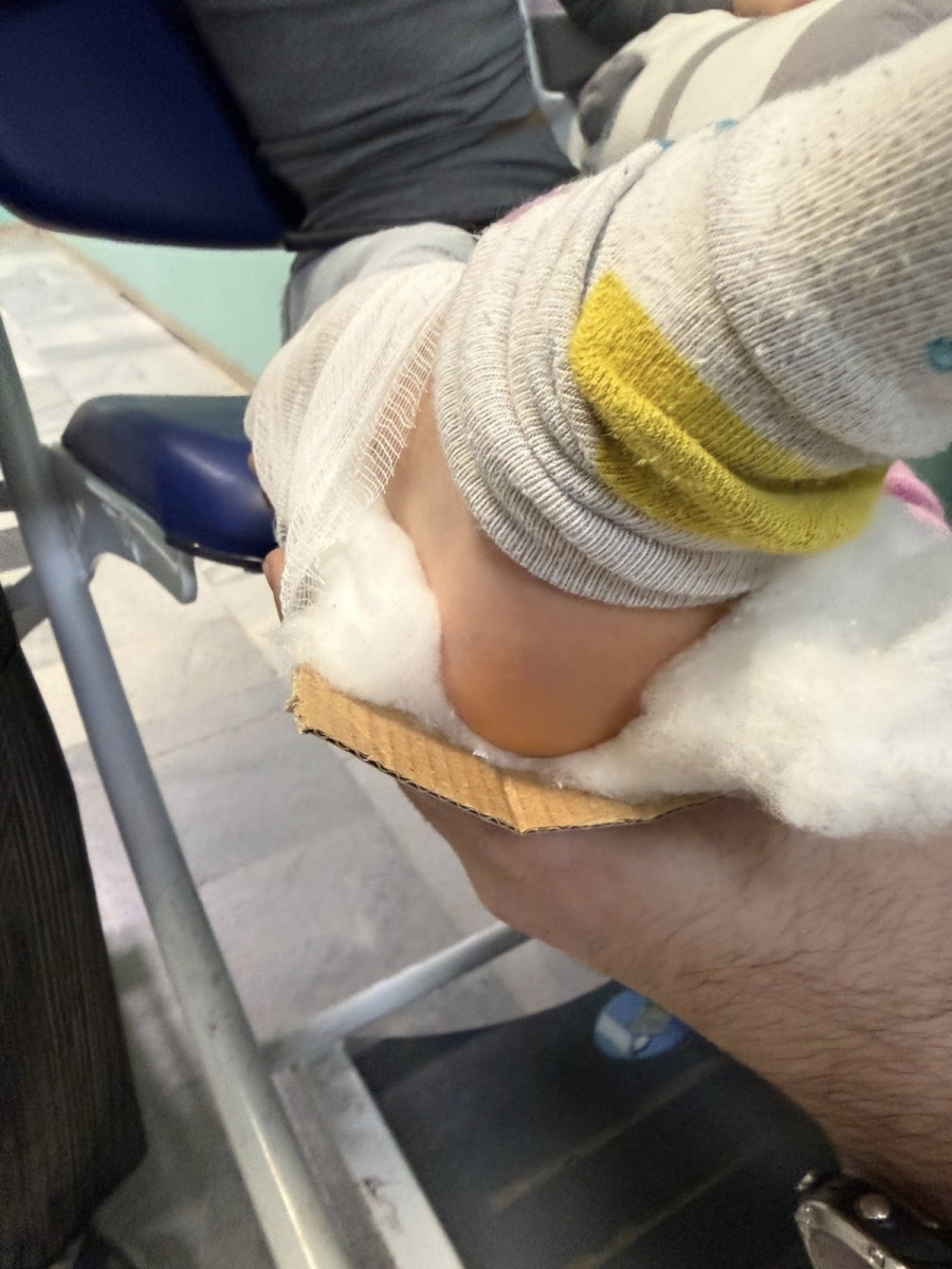 Спешна помощ в Разлог: „Шинираха“ 6-годишно дете със счупен крак с картон от кутия за пица (СНИМКИ)