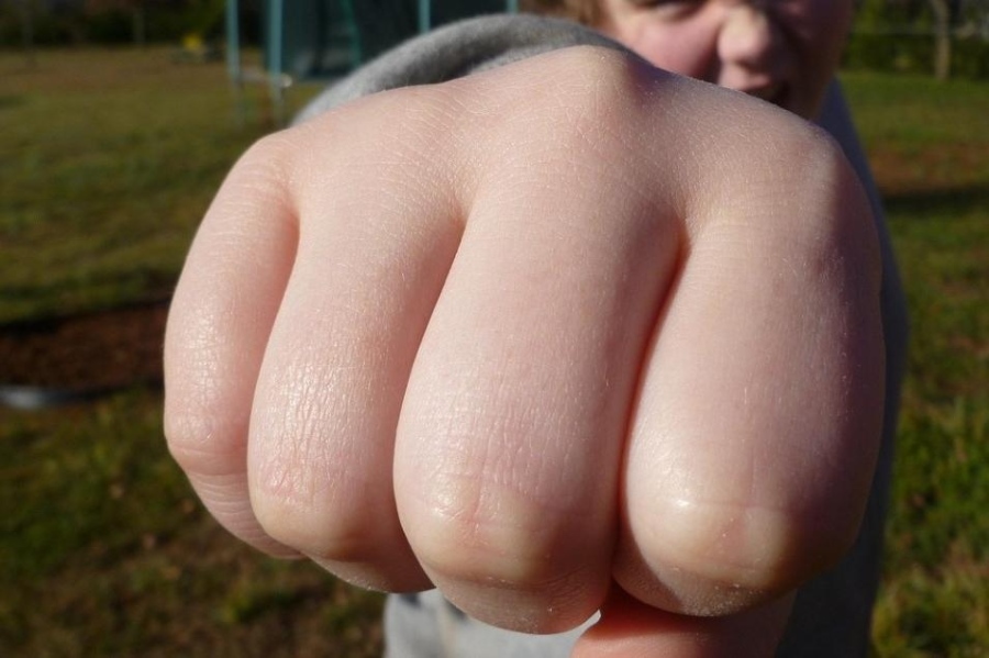 14-годишен заби юмрук в окото на връстник от Самораново, полицията разследва