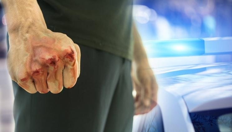 Мъж от Ихтиман строши носа на жена си: биячът в ареста, жертвата отказала лечение