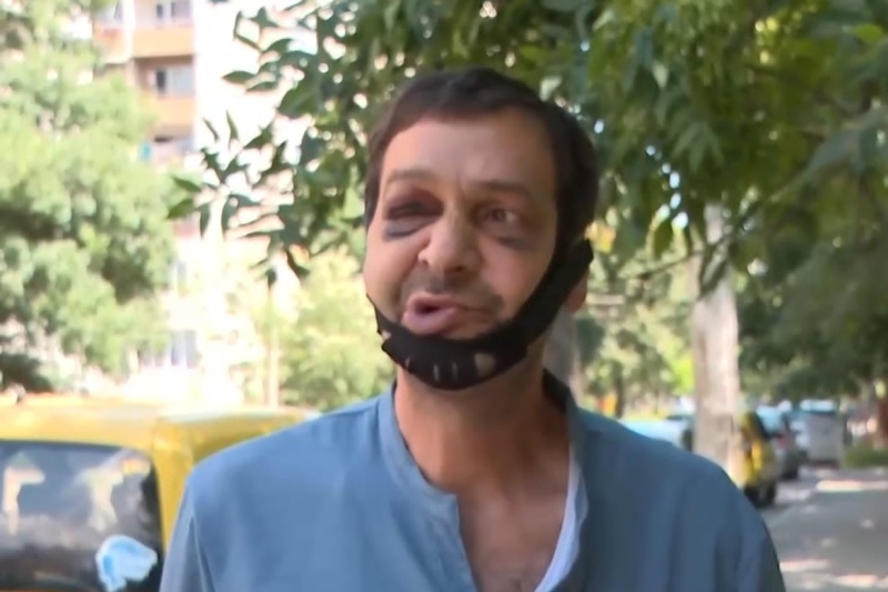 След жестокото нападение на таксиметров шофьор в Перник: Браншът настоява за камери и паник бутони в автомобилите